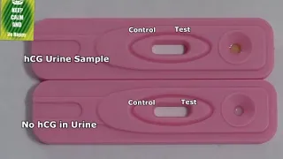 Pregnancy test :- Positive vs Negative Result time lapse| #A live pregnacy test | Teen mom review