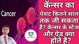 Cancer Life Expectancy। कँसर होने के बाद पेशंट कितना जी सकता है?केन्सर के स्टेजस और ग्रेड्स।