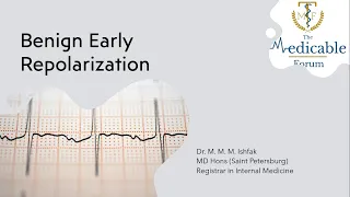 Benign Early Repolarization - ECG