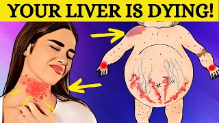 SILENT THREAT! These 8 Signs Could Indicate Fatty Liver Disease!