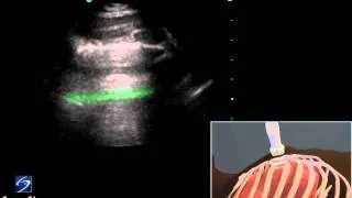 How To: Lung Ultrasound Examination 3D Video