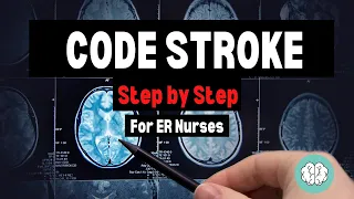 CODE STROKE - Explained for new Emergency Nurses!