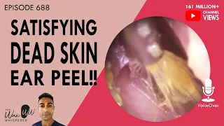 688 - Satisfying Dead Skin Ear Peel!