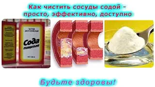 Как чистить сосуды содой — просто, эффективно, доступно