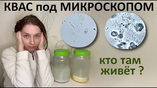 Квас хороший и плохой под микроскопом. Разница в микробиоме.