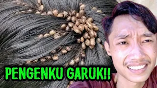 GIL4!! KUTU HEWAN DI RAMBUT MANUSIA INI BIKIN PHOBIA!!