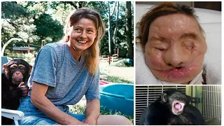 Woman Left UNRECOGNISABLE After Brutal Pet Attack | Travis The Chimpanzee Story