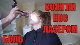 Я СНЯЛ НА ВИДЕО СВОЮ ОПЕРАЦИЮ