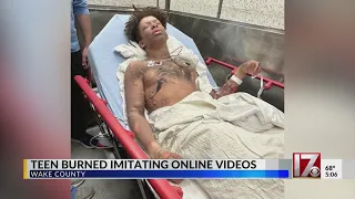 Wake Forest teen badly burned after imitating online videos; mom warns others