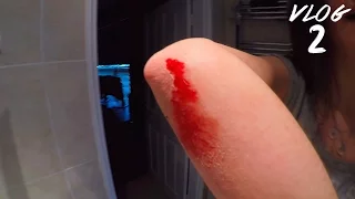 EPIC LONGBOARDING FAIL!! (PAINFUL AND BLOODY)