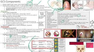 Critical Care Class NURSING 09 of 16   Neuro Part 01 of 02   CCC 2023