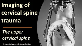 Imaging of Upper Cervical Spine Injuries