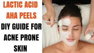 CHEMICAL PEELS for acne prone skin