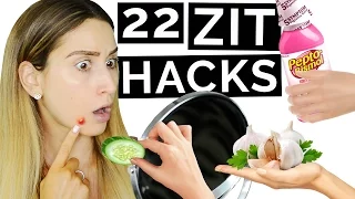 22 Acne & Pimple Hacks That Work FAST!