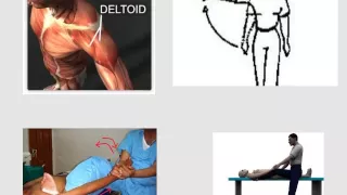 dislocation of the shoulder (ulf1)