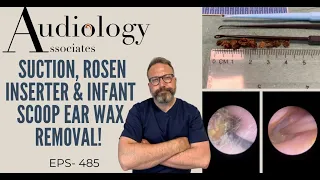 SUCTION, ROSEN INSERTER & INFANT SCOOP EAR WAX REMOVAL - EP485