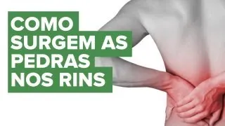 Como se forma o cálculo renal ou pedra nos rins? - Educar para Prevenir Fundação Pró-Rim