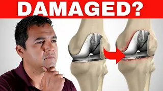 3 Clear Signs That You May Have Damaged Your Knee Replacement