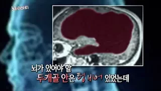 [서프라이즈] 뇌가 없는데 IQ126이라고?