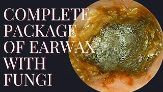 COMPLETE Package of Earwax With Fungi