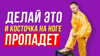 Как убрать косточку на ноге в домашних условиях? Упражнения, для лечения большого пальца ноги!