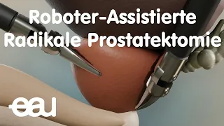 Roboter-Assistierte Radikale Prostatektomie