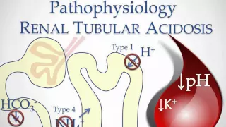 Renal Tubular Acidosis - USMLE STep 2 Review