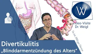 Divertikulitis: Plötzliche starke Bauchschmerzen links? Typische Symptome | Ernährung | Operation