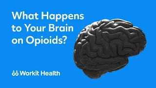 What happens to your brain on opioids?