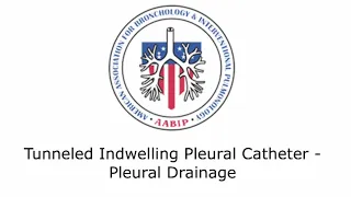 Tunneled Indwelling Pleural Catheter - Pleural Drainage