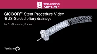 Niti S™ GIOBOR™ Stent procedure video for EUS-guided biliary drainage