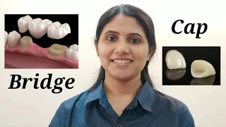 नया दांत कैसे बिठाते हैं? Tooth Cap & Bridge: Types, Procedure