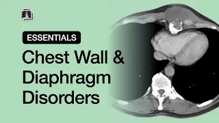 Chest Wall & Diaphragm Disorders | Chest Radiology Essentials