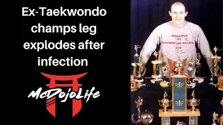 McDojoNews: Ex-Taekwondo Champs Leg Explodes After Infection