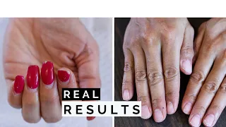 How to REMOVE ACRYLIC NAILS