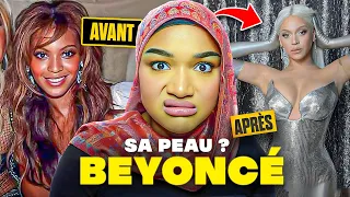 BEYONCÉ : SA TRANSFORMATION GRÂCE A LA CHIRURGIE!!😱🍑💉