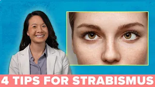 4 Great Ways to Treat Your Strabismus