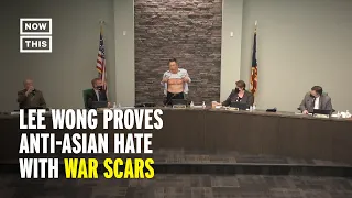 Official Shows War Scars to Call Out Anti-Asian Hate