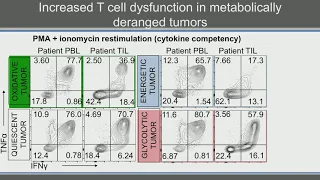 Tumor Microenvironment Metabolism: effects on anti-tumor and pro-tumor immunity