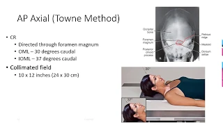 Radiographic Positioning of the Skull