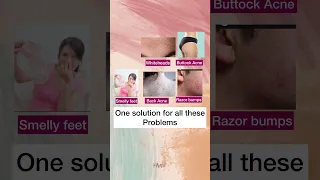 One solution for whiteheads, razor bumps, back acne & body odour #shorts #ytshort #skincare #review