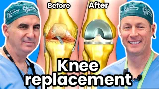 Knee Replacement - How To Know If You Need One?