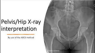 Pelvis/Hip X-ray interpretation