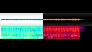 Igorrr - Nostril - Dentist - 11 - 2010 (+dynamics and bass)