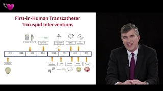 EACVI free webinar: How to use multi-modality imaging for transcatheter interventions? (III)