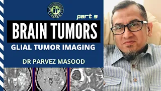 Parvez Masood | Brain Tumors part 3 | GLIOMAS | GLIOBLASTOMA MULTIFORME | CLASSIFICATION & IMAGING