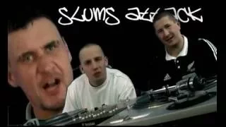 Peja/Slums Attack - Co Cię boli?!