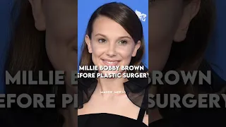 Millie Bobby Brown before and after plastic surgery **no hate**