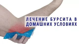 Лечение бурсита в домашних условиях