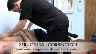 Sciatica / Herniated disc, limping - Helped using Gonstead Chiropractic NYC